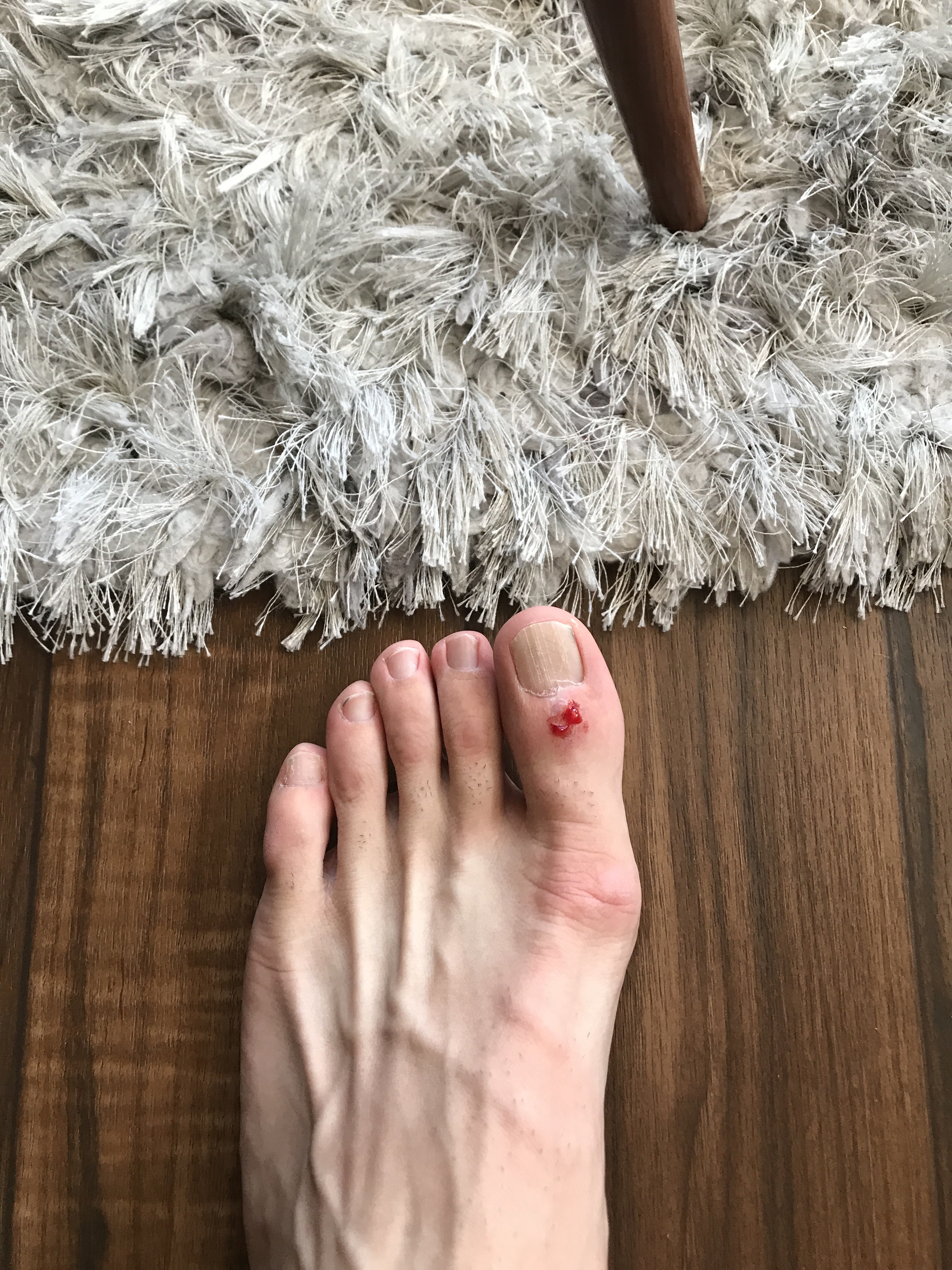 Free Feet Pics - TomsToes